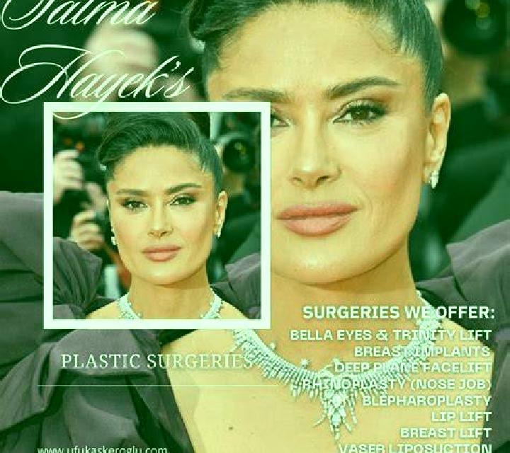 Salma San Bartolome escort